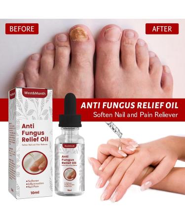Quick Relief Oil Fungal Nail Treatment Rapid Relief Oil Nail Fungus Treatment For Toenail Nail Treatment Oil Toe Nail Fungal Treatment Onychomycosis Nail Treatment Toenail Repair for Damaged Nails - Buy Online on GoSupps.com
