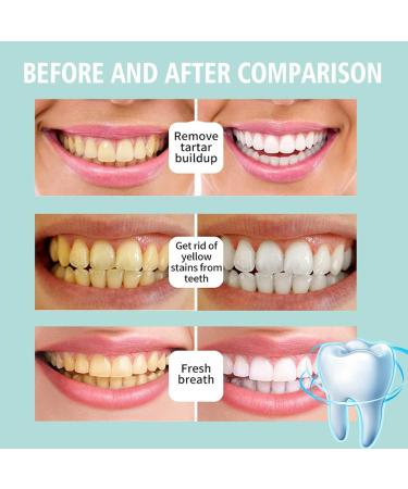 Teeth Whitening Mouthwash & Mousse Foam - Bad Breath Elimination & Stain Removal | Brightening Oral Repair (2 PCS) - Buy Online on GoSupps.com