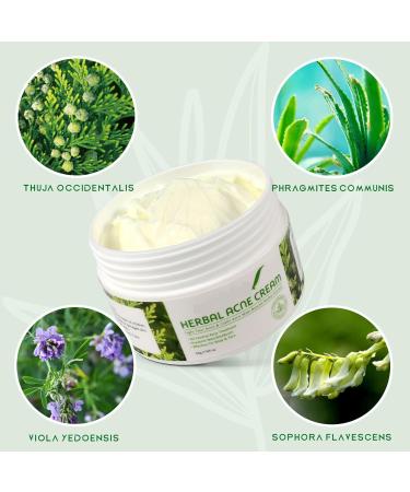 Antiacne cream face cream face cream antipimples quickly reduces blemishes targeted solution against pimples - Buy Online on GoSupps.com