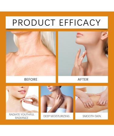 Turmeric Body Lotion Vitamin C Turmeric Body Lotion Deep Hydration Body Lotion Repair Dry Skin - Turmeric Body Treatment Lotion For Smooth Nourished Skin (3) - Buy Online on GoSupps.com