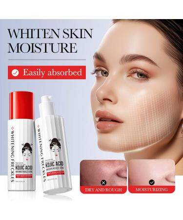 Skin whitening cream visibly lightens the skin reduces dark spots and dyschromia for a radiant youthful complexion - Buy Online on GoSupps.com