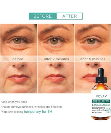 2.5 Retinol Face Care Serums 30ml Skin Moisturize Bright Anti-Age Essence Pore Minimizer Dark Spot Fine Line Wrinklee Remover Brightening Facial for Day & Night Use - Buy Online on GoSupps.com