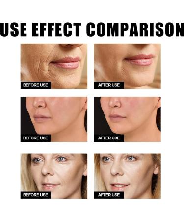 Retinol Serum for Face - Coffee Extract Face Serum - Anti-Aging & Anti Wrinkles Face Serum for Women - Vitamin C Serum for Face - Face Care Squalane Hydrating Serum - Facial Serum - Skin Care Serum - Buy Online on GoSupps.com