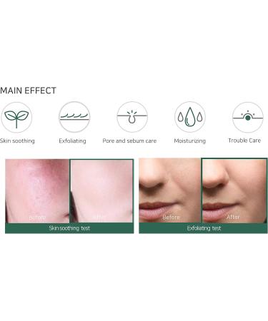 SOME BY MI AHA-BHA-PHA 30 DAYS MIRACLE SERUM (50ml) - Functional cosmetic serum - Buy Online on GoSupps.com