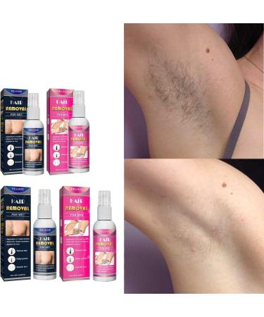 Spray D pilatoire Rafra chissant for Les Aisselles for Femmes 30 ML - pilation Multi-usages Douce Et Non Irritante for Une Peau Douce Et Soyeuse(2PCS) - Buy Online on GoSupps.com