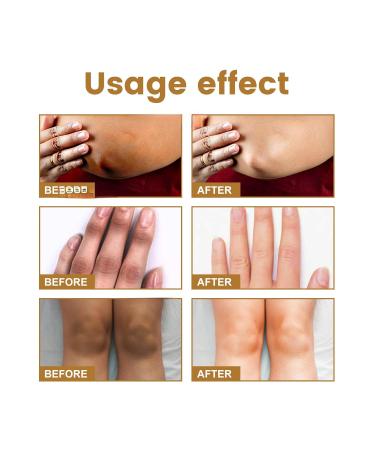 Pawmi Black Spur Essence for Knuckles Lightens and Brightens Skin on Hand Joints - Buy Online on GoSupps.com