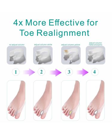 Adjustable Toe Separator & Corrector for Women - Large Size 8-10 (2PC) - Ashomie New Generation - Buy Online on GoSupps.com