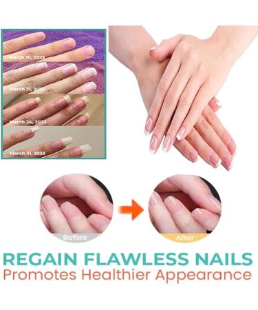 Vitamin Nail Strengthening Cuticle Oil with dropper For Fingernail Or Toenail Nail Strengthener Oil For Damaged And Weak Nails 15ml Lavender scent - Buy Online on GoSupps.com
