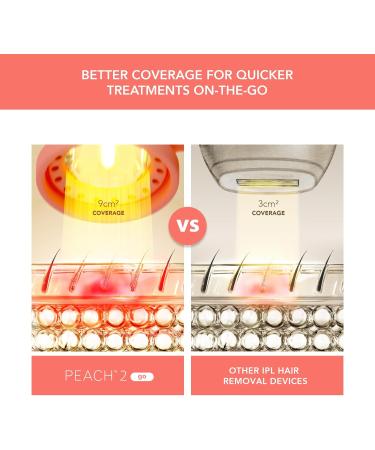Foreo Peach 2 Go IPL Hair Removal Device - Permanent Painless Laser Hair Removal for Body & Face - Skin Cooling & Silicone Shield - Alternative to Epilator for Women - Buy Online on GoSupps.com