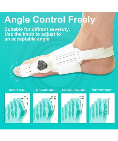 Orthopedic Bunion Corrector for Women & Men - Adjustable Toe Straightener with Silicone Pad and Heel Strap - Buy Online on GoSupps.com