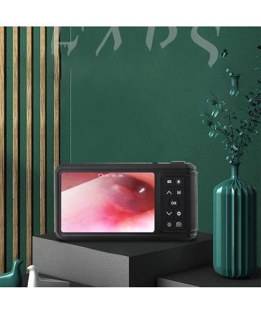 QIYUDS Ear Wax Removal - 4.5-inch Large-Screen HD Otoscope Ultra Clear View Ear Camera with Wax Remover 3.9mm Ear Endoscope with LED Lights Ear Cleaning Camera with Ear Sp with 32GTF Card - Buy Online on GoSupps.com