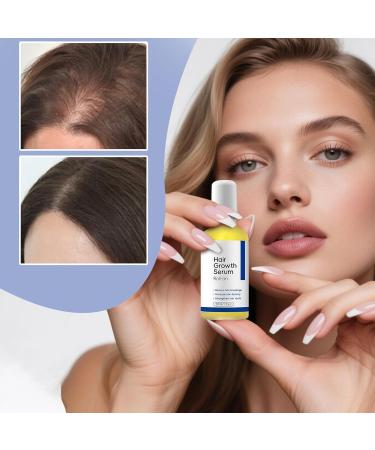  Yuemxixi Hair Regrowth Natural Scalp Care Roller 30ml Natural Hair Thickening and Growth | For Frizz Follicles Slimming Health Men Seniors Home Travel - Buy Online on GoSupps.com
