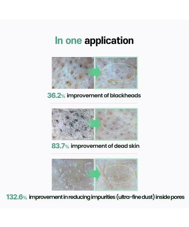 Buy Ilso Natural Mild Cleansing Oil - Daily Makeup & Blackheads Removal 200mL | International Shipping Available - Buy Online on GoSupps.com