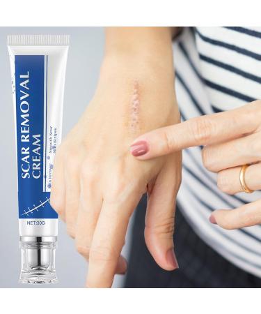 Burn Scars Removal Cream | 30g Brand Repair Product - New Scars Firming Cream - For Recovery Cheloid Injury Women Men Athletes - Buy Online on GoSupps.com