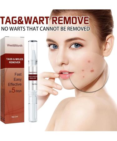 Liqui Skin Removal Wipe Off Tags And Moles Skin Mole Remover LiquiNatural Non-Irritating Mole Pen Wart Repair Pen - Buy Online on GoSupps.com