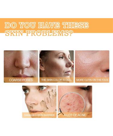 Glycolic Acid 7% Toning Resurfacing Solution Glycolic Sour 7% Toner Glycolic Acid Skin Toner Hydrating Toning Solution for Face Glycolic Acid Toner for Blemishes and Acne and Rejuvenate Your Skin - Buy Online on GoSupps.com