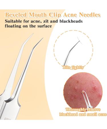 JIEYAO 4-Piece Tweezers Set for Removing Blackheads Pimple Ejector Tool Set Blackhead Extractor Tweezers for Whiteheads Blemishes Comedones Make-Up Tool Made of Stainless Steel - Buy Online on GoSupps.com