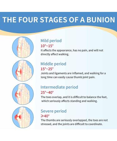 Bunion Corrector Support Brace for Women and Men - Orthopedic Sleeve Spacer Separator for Hammer Toe Pain Relief - Hallux Valgus Bunion Socks (Medium) - Buy Online on GoSupps.com