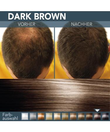 Premium 30G Hair Cover for Men & Women | 100% Natural Dark Brown | Stray Hair Sealing & Staking Solution | Authentic Look - Buy Online on GoSupps.com