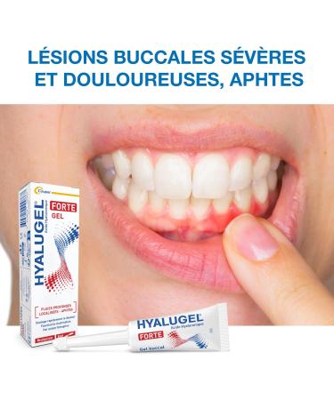 HYALUGEL - Oral gel - Deep localized wounds - Severe and painful oral lesions - Aphthae - Hyaluronic Acid - Tube - 8 mL - Buy Online on GoSupps.com