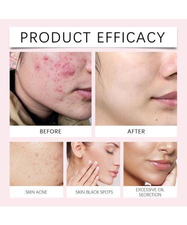  BEROZA Avanise Pack of 40 Kojic Acid and Turmeric Cleansing Pads 30ml Turmeric Essence Kojic Acid and Turmeric Cleansing Pads Azuveas Pads for Face and Body (A) - Buy Online on GoSupps.com