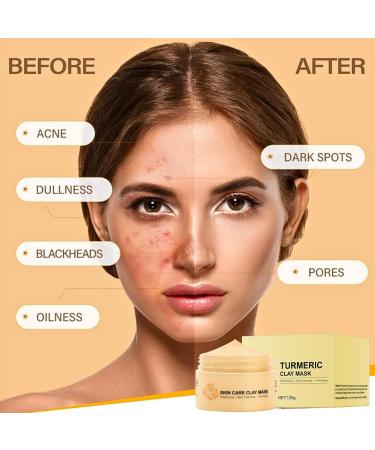 Turmeric Face Mask Vitamin C Clay Mask Deep Cleansing Pore Mask Clay Face Mask Mud Mask for Face for Radiant Skin Oil Balance Face Masks Skincare for Pore Blackhead Blemish and Acne - Buy Online on GoSupps.com