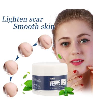 Scar Gel - Skin Repair and Removal Treatment for Face, Body, Surgery, Burns, Stretch Marks - Buy Online on GoSupps.com