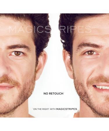 Magicstripes Large Eyelid Correction Patches - 64 Pieces for Instant Lift & Perfect Eyes | Shop Now! - Buy Online on GoSupps.com