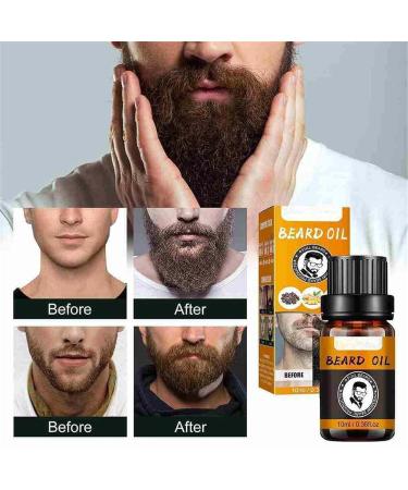 Beard Care Essential Oil & Growth Balm | 100% Natural Ingredients | Perfect Gifts for Men - Buy Online on GoSupps.com