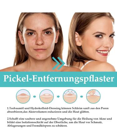 Fonyiunce 300 pieces pimples for daily and evening use invisible hydrocolloid acne patches with tea oil and salicylic acid can eliminate acne quickly - Buy Online on GoSupps.com