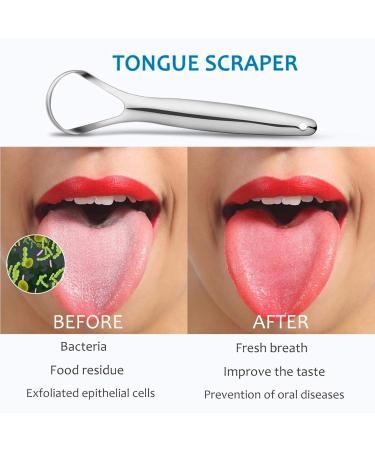 Premium Surgical Stainless Steel Tongue Scraper - Effective Bad Breath Cleaner for Adults & Kids | Buy Now - Buy Online on GoSupps.com