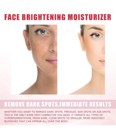 Fyearfly Kojic Acid Skin Whitening Cream Kojic Acid Whitening Moisturizer 2 Pcs Facial Moisturizer Kojic Acid Moisturizing Facial Nutrition Cream for Lightening Spots - Buy Online on GoSupps.com