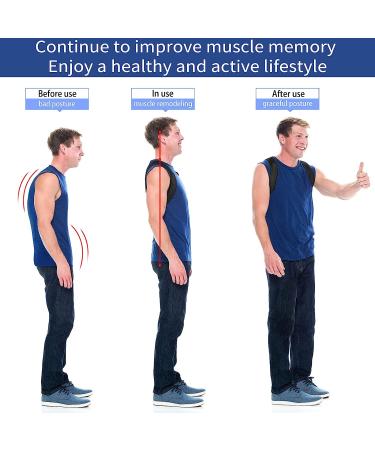 MYSEXY Posture Corrector Upper Back Brace for Women and Men - Pain Relief Belt for Neck, Shoulder, and Back Support - Adjustable and Breathable - Buy Online on GoSupps.com