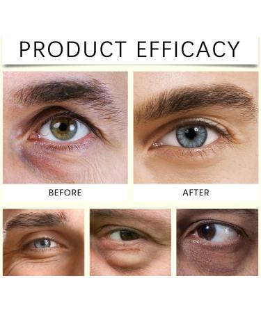 XINRAN Retinol Firming Eye Cream for Dark Circles Puffy Eyes Firming Under Eye Cream with Reduction of Fine Line Wrinkles Moisturizing Eye Care for Men and Women 4 4 Pieces - Buy Online on GoSupps.com