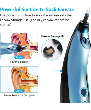 Rotatable Ear Wax Removal Vacuum Cleaner with Light - Electric Ear Cleaner for Adults & Kids - Blue - Buy Online on GoSupps.com