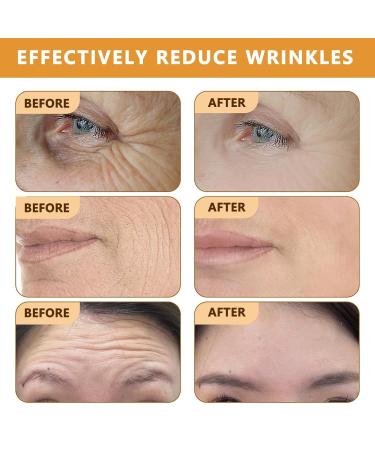 Bee Venom Wrinkle Removal Cream Anti-Aging Restore and Enhance Skin Elasticity Natural and Non-Irritating Suitable for Sensitive Dry Oily Skin 51 Fl Oz (Pack of 1) - Buy Online on GoSupps.com