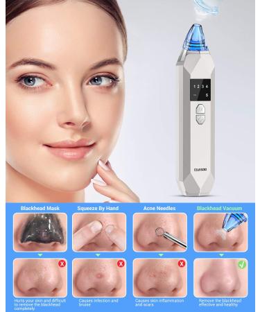 EUASOO Blackhead Remover Vacuum Kit | USB Rechargeable Facial Pore Cleanser with 5 Probes and 5 Suction Power Levels for Skin Treatment - Buy Online on GoSupps.com