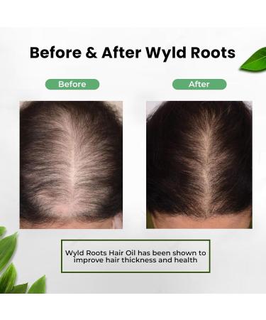 Natural Hair Growth Oil | Rosemary Biotin & Castor Oil | Stronger Thicker Hair for Men & Women - Ships Internationally - Buy Online on GoSupps.com