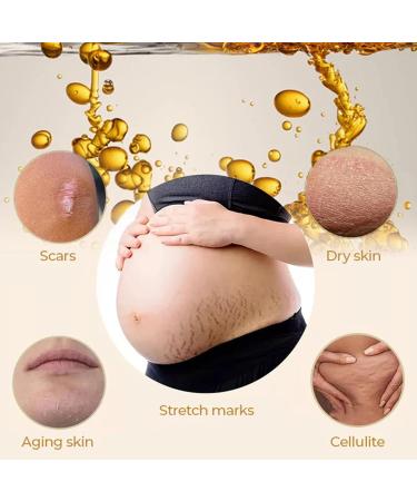 Ranley Oil for Stretch Marks Olive Belly Oil Intensive 52 oz Tightening Natural Moisturizing Pregnant Belly Oil for Stretch Marks - Buy Online on GoSupps.com