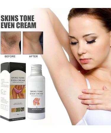 Skin Tone Even Cream 30 ml Skin Brightening Cream Lightening Cream for Armpits Even Skin Tone Body Cream for Women Private Parts Body Cream (5PCS) - Buy Online on GoSupps.com