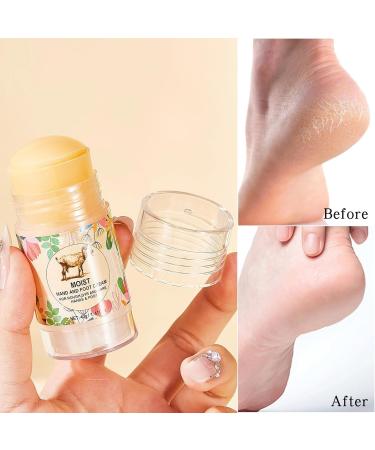 Stick Cr me Anti-Fissures Pieds | Cr me R paratrice Talon Fissur Homme - Soin Podologique Non Gras pour Femme Homme Adolescents Grands-parents | pour Femme Ado Jeune et Grands-Parents - Buy Online on GoSupps.com