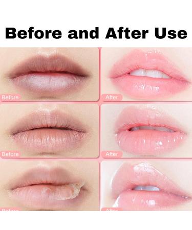 Lip Scrubs Kit: Mint Lip Sugar Scrub and Exfoliator for Dry, Chapped Lips - 2 Pack - Buy Online on GoSupps.com