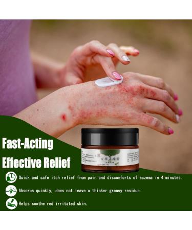 All-Natural Eczema & Psoriasis Cream for Sensitive Skin | Herbal Anti-Itch Lotion for Dermatitis, Shingles, Acne & Rosacea | Soothing Moisturizer for Dry, Itchy Skin (1.06oz & 5.50oz Options) - Buy Online on GoSupps.com