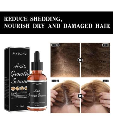 Allurium Hair Growth Serum for Black Women - Fast Natural Hair Growth & Repair - 2023 New Formula - Set of 3 - Buy Online on GoSupps.com