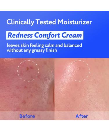 SOONDING Coconut Korean Glass Skin Triple Set - Coconut Jelly Pudding Pore Cleanser (50ml 1.69 fl oz) Water Glow Calming Serum Hydro Barrier Cream Set - Buy Online on GoSupps.com