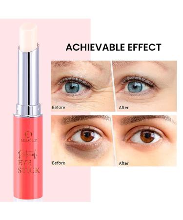 Retinol Eye Cream Stick - Anti-Aging Treatment for Dark Circles, Puffiness, and Wrinkles - Brightening Under Eye Balm - Buy Online on GoSupps.com