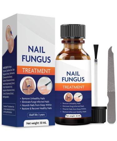 Nail Fungus Treatment for Toenail, Toenail Fungus Treatment, Toe Nail Fungus Treatment Extra Strength, Fungus Nail Treatment, Nail Fungus Treatment for Nail, Fungus Treatment for Fingernails 30ML Deep Blue