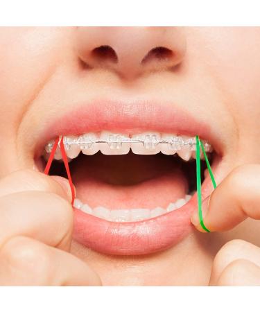 JMU Orthodontic Neon Elastics 3/16 Inch Heavy 6.5oz 500 Pack - Latex Free Dental Rubber Bands - Made in USA - Buy Online on GoSupps.com