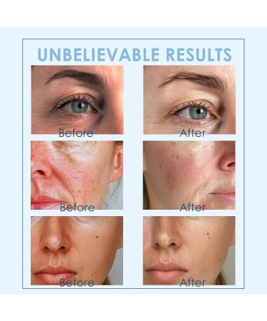 Premium Ice Globes for Facial & Eye Care - Cooling Beauty Tool for Women | Reduce Puffiness & Redness | Blue Quicksand - Buy Online on GoSupps.com