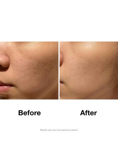 Marine Essence Collagen Infused Hydrating Sheet Mask - 5 Pack with Apple Stem Cells Aloe Vera & Vitamins B5 & E for Glowing Skin - Buy Online on GoSupps.com